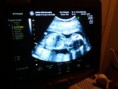 /album/mundo-ecografico/a2012-01-18-14-37-55-jpg/